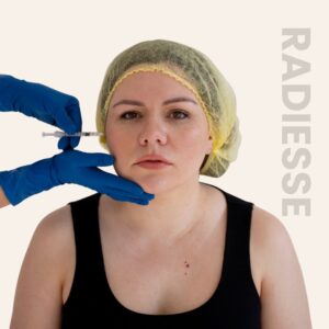 Radiesse